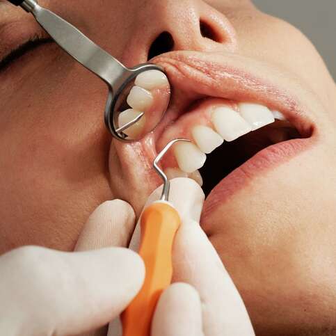 3 Essential Dental Services Offered By Dental Clinics in Toronto