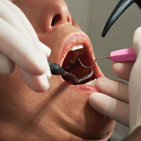 4 Cosmetic Dentistry Services Offered By QQ Dental Care