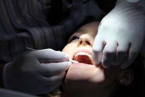 Looking for a Dentist in Toronto?